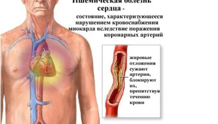 Схватились за сердце