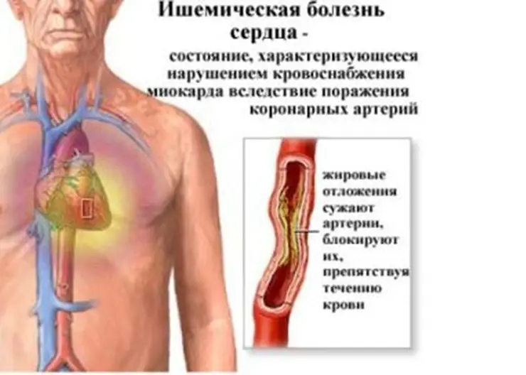 Схватились за сердце