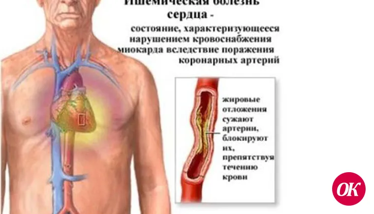 Схватились за сердце