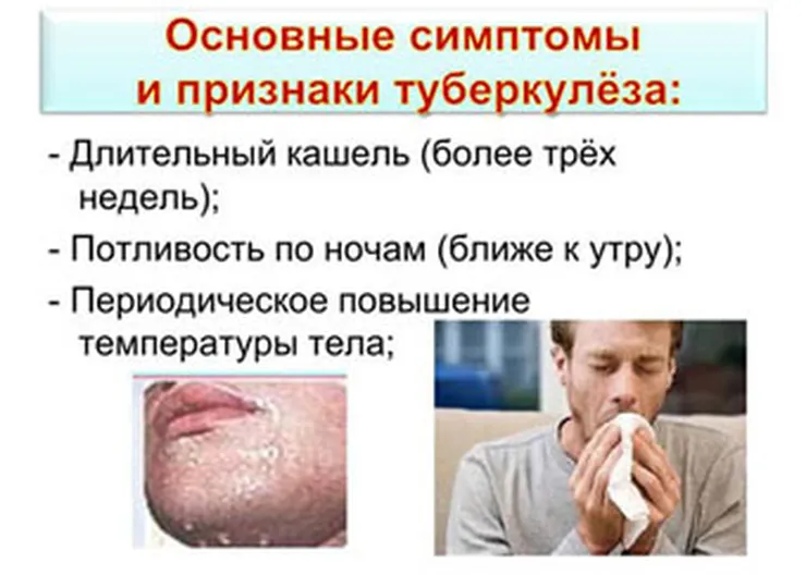 http://www.ognikuban.tw1.ru/wp-content/uploads/2017/03/1wata_youre_to_know_bjut_tuberculouse2