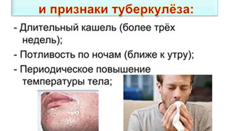 http://www.ognikuban.tw1.ru/wp-content/uploads/2017/03/1wata_youre_to_know_bjut_tuberculouse2