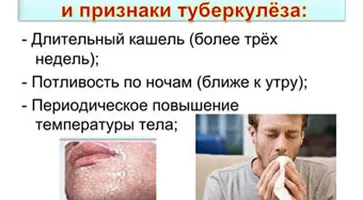 http://www.ognikuban.tw1.ru/wp-content/uploads/2017/03/1wata_youre_to_know_bjut_tuberculouse2