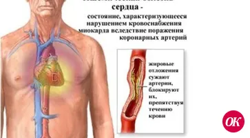 Схватились за сердце