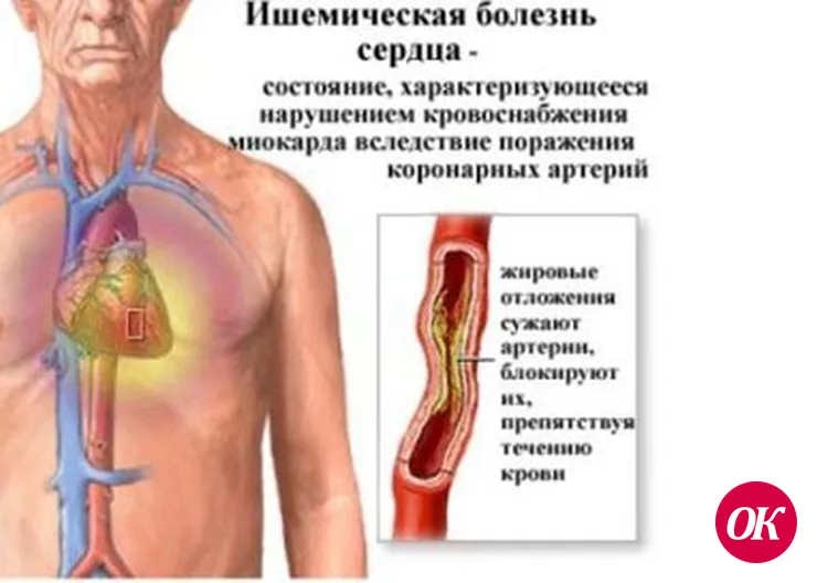 Схватились за сердце