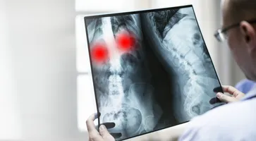 https://ognikubani.ru/wp-content/uploads/2023/03/doctor-with-a-coronavirus-patient-39-s-x-ray-film_1