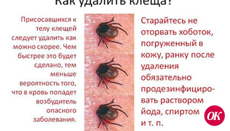 Если впился клещ